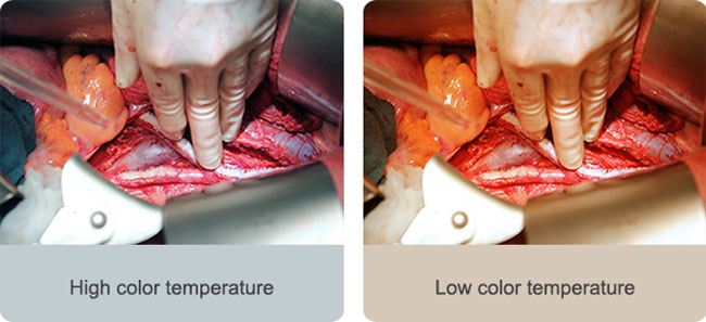 color temperature